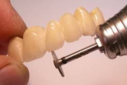 Методы работы с алмазным стоматологическиим инструментом